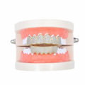 Gold Upper Teeth