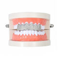 Silver Upper Teeth