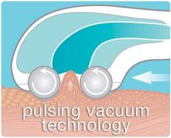 Pulsing technology diagram