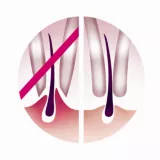 Gentle tweezing discs