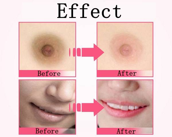 AFY Lip Private Part Nipple Bleaching Whitening Fresh Up Pinkish Cream