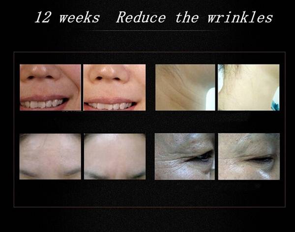 Argireline Anti-aging Concentrate Anti Wrinkle Essence Cream