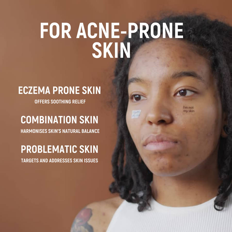 Acne.org.za - HYDRATE - Anti-inflammatory & Deep nourishing moisturiser