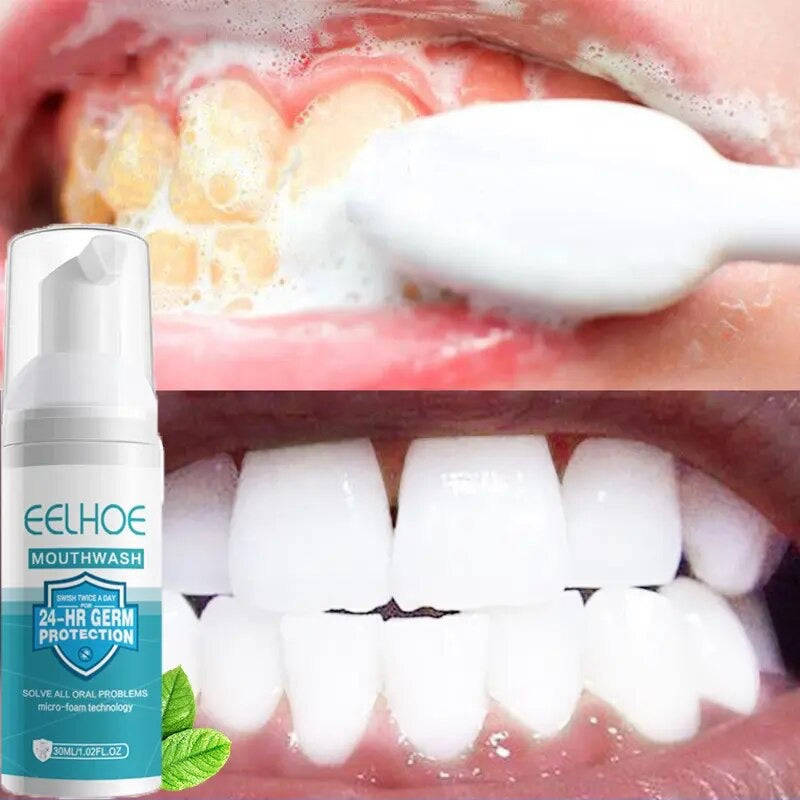 Teeth Whitening Mousse Toothpaste Dental Bleach Cleaning Tools Removes Stains Oral Hygiene Fresh ...
