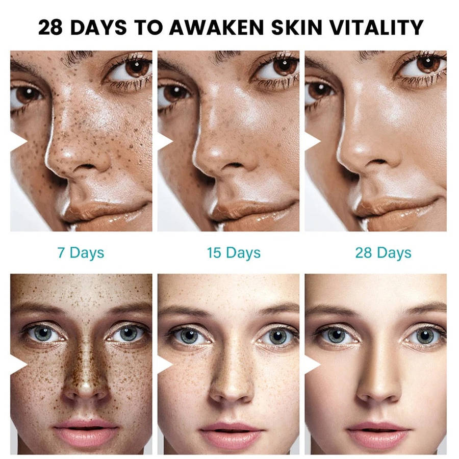 Dark Spot Corrector Cream Skin Whitening Spot Fade Anti-aging Cream For Women Girls Evens Skin To...