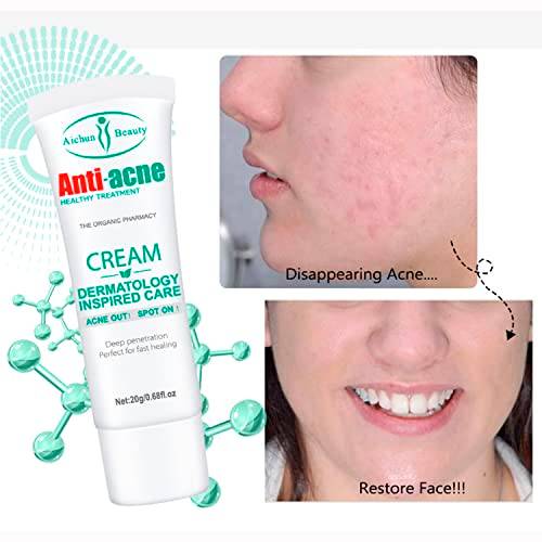 Aichun Beauty Anti-Acne Cream 20g - AC2001
