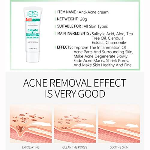 Aichun Beauty Anti-Acne Cream 20g - AC2001