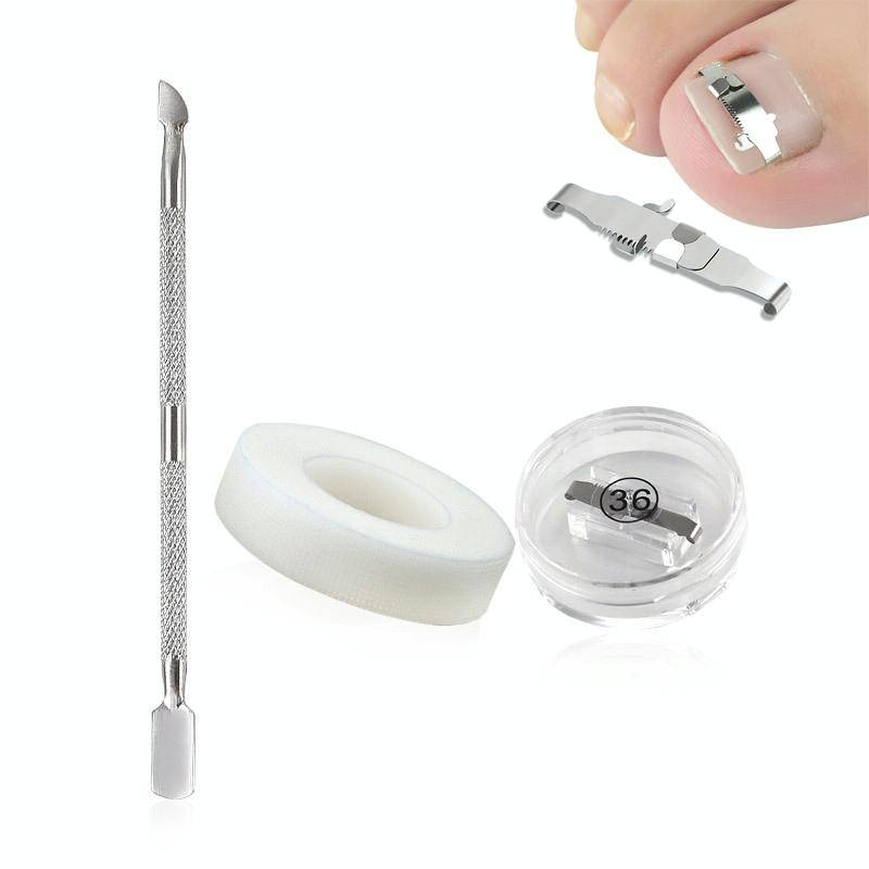 Orthopedic Buckle Toe Nail Groove Ingrown Nail Corrector, Style:No. 44, Specifications:Set