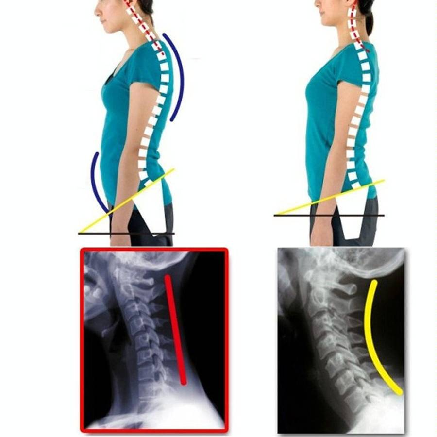 Adjustable Women Back Posture Corrector Shoulder Support Brace Belt Health Care Back Posture Belt...