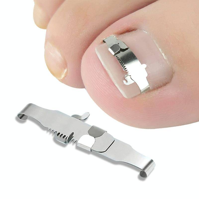 Orthopedic Buckle Toe Nail Groove Ingrown Nail Corrector, Style:No. 42, Specifications:Set
