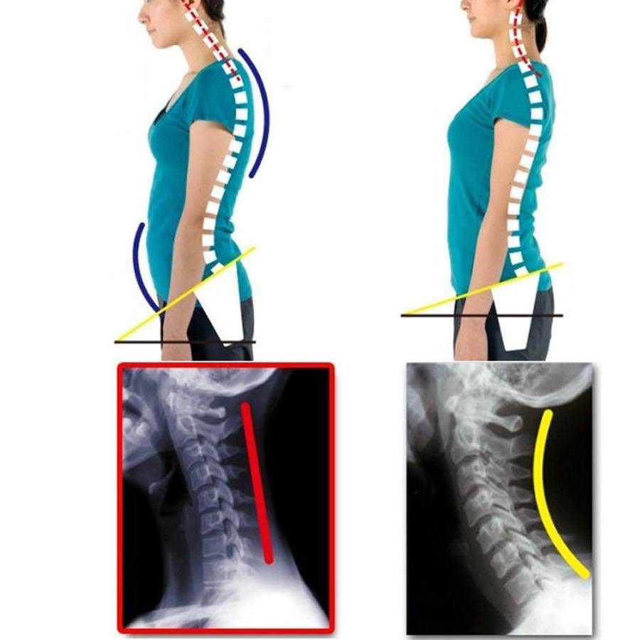 Adjustable Women Back Posture Corrector Shoulder Support Brace Belt Health Care Back Posture Belt...
