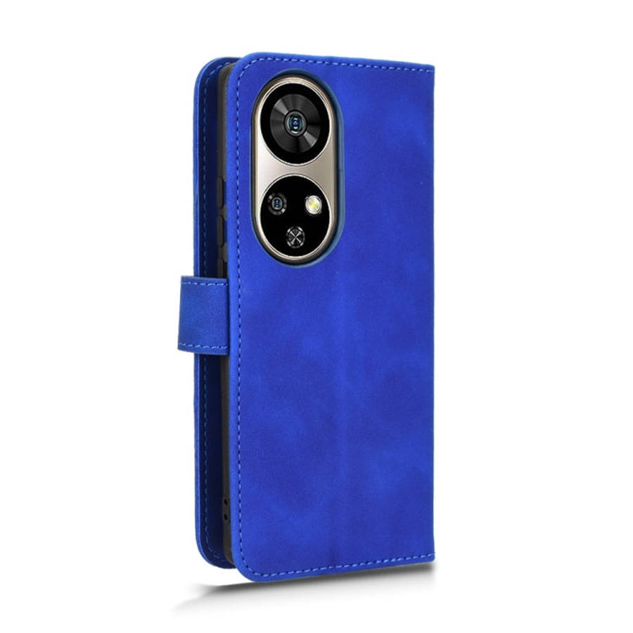 For Ulefone Note 17 Pro Skin Feel Magnetic Flip Leather Phone Case(Blue)