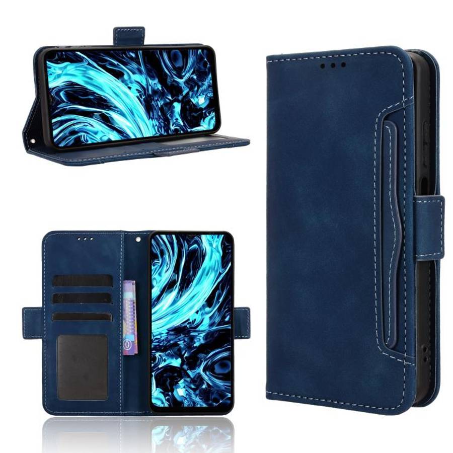 For Doogee Note 56X / Note 56X Pro Skin Feel Calf Texture Card Slots Leather Phone Case(Blue)