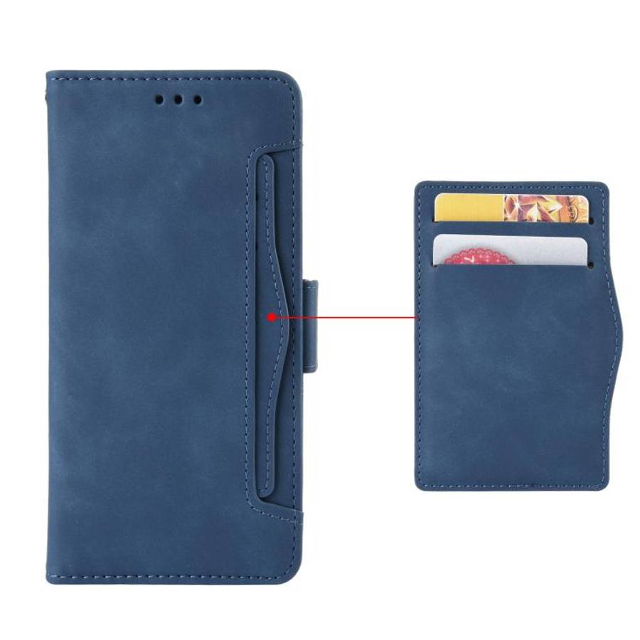 For Doogee Note 56X / Note 56X Pro Skin Feel Calf Texture Card Slots Leather Phone Case(Blue)