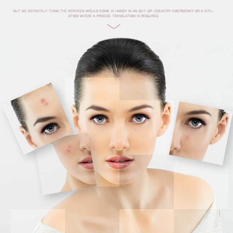 SONGSUN X2 Professional Portable Skin Spot Tattoo Freckle Removal Machine Mole Dot Removing Laser...