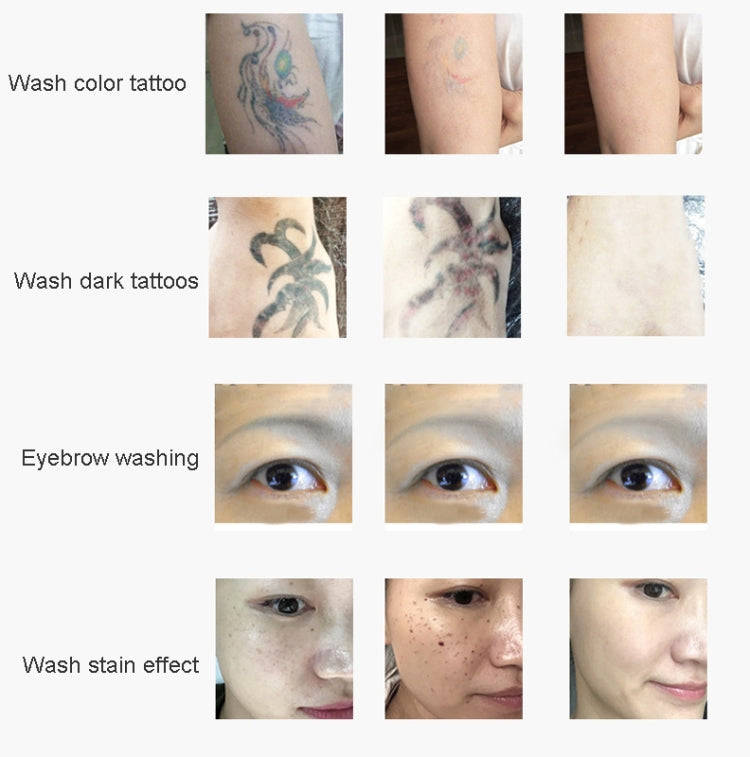 Laser Tattoo Removal Machine Non-invasive Eyebrow Washing Beauty Equipment(AU Plug)