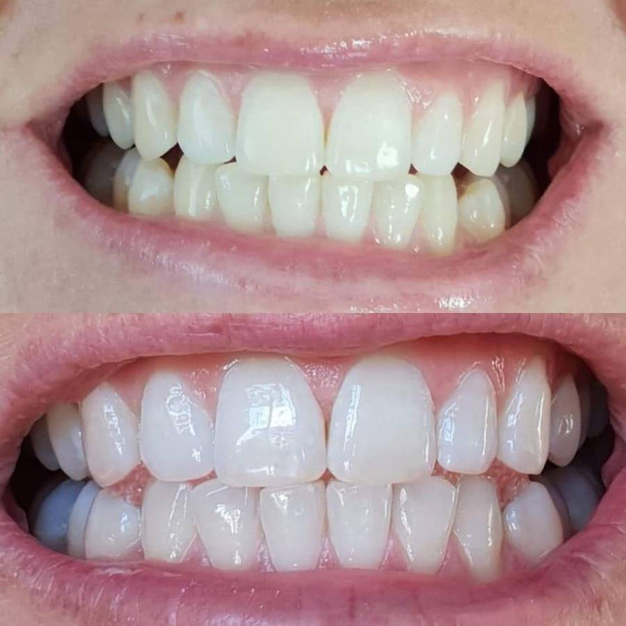 NU SKIN AP24 Whitening Fluoride Toothpaste