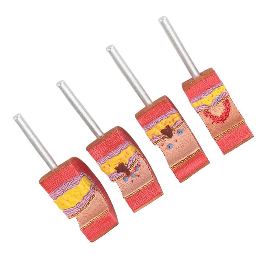 7PCS Artery Anatomy Model Anatomical Vessel Atherosclerosi