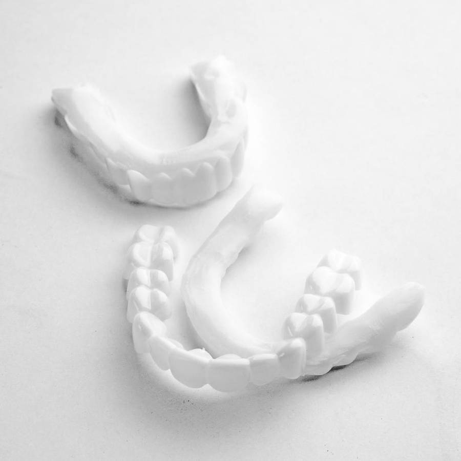 True-Smile Instant Teeth Cap Veneers