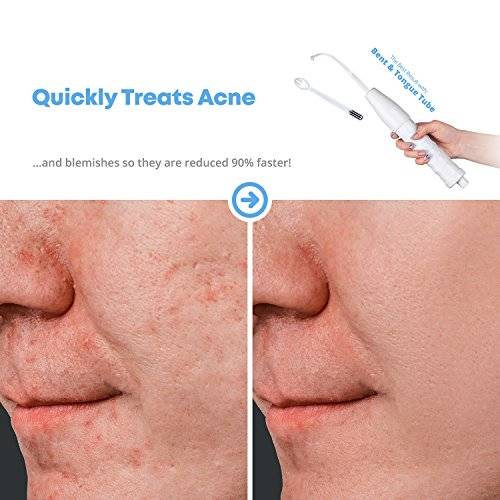 NuDerma Skin Therapy Wand - Portable Handheld High Frequency Skin Therapy Machine - Acne..
