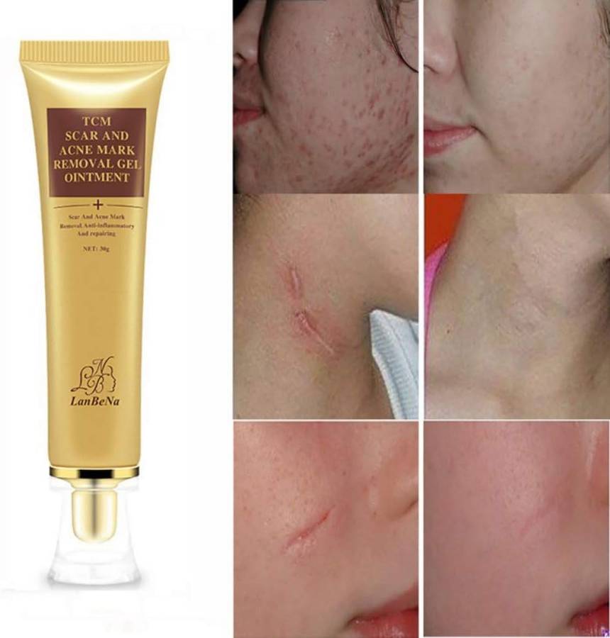 Acne Scar Removal Cream, Skin Repair Cream Scar Cream Gel Scar Treatment for Face and Body Scar Acne