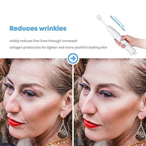 NuDerma Skin Therapy Wand - Portable Handheld High Frequency Skin Therapy Machine - Acne..