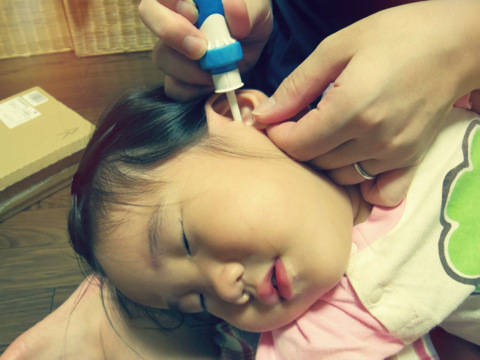 Electric Vacuum Ear Cleaner Ear Wax Safe Remover Vibration Removal Cleaning Painless Cordless Safety