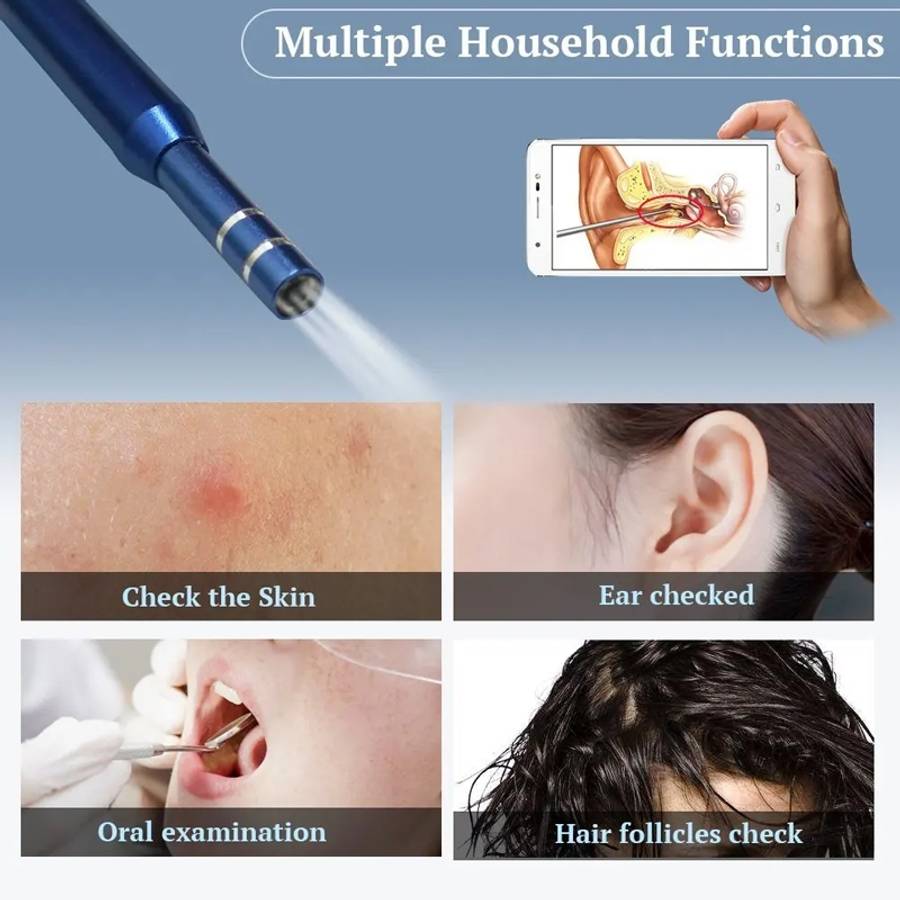 i95 3 in 1 USB Ear Scope Inspection HD 0.3MP Camera Visual Ear Spoon for OTG Android P ... (Black)