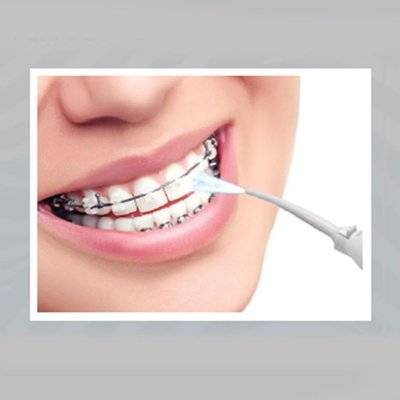 Igia Pressure Water Flosser Picture 2