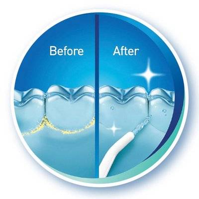 Igia Pressure Water Flosser Picture 7