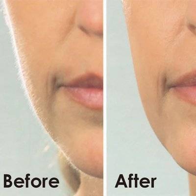 Igia Facial Dermaplaner Hair Remover
