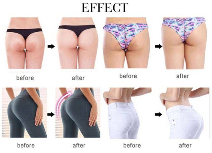 Hip Firming Cream Hip Shaping Cream - Medical Formula -100ml