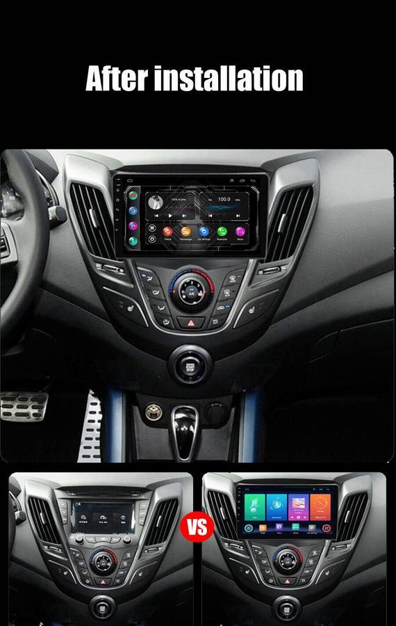 For Hyundai Veloster FS 2011-2017 DAB+ Android Auto Radio GPS Navigation CarPlay