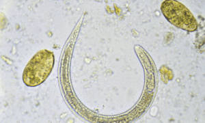 Parasite 2