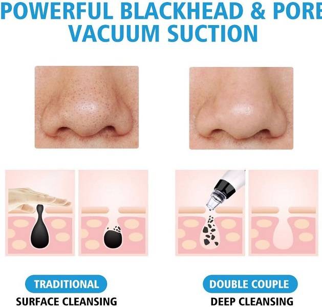 183716 Microcrystalline Black Head Remover