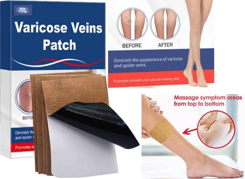 Royal Prestige Varicose Veins Patch 2 Pack