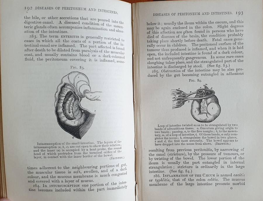 * 1886 * Fenwick's Medical Diagnosis - Samuel Fenwick