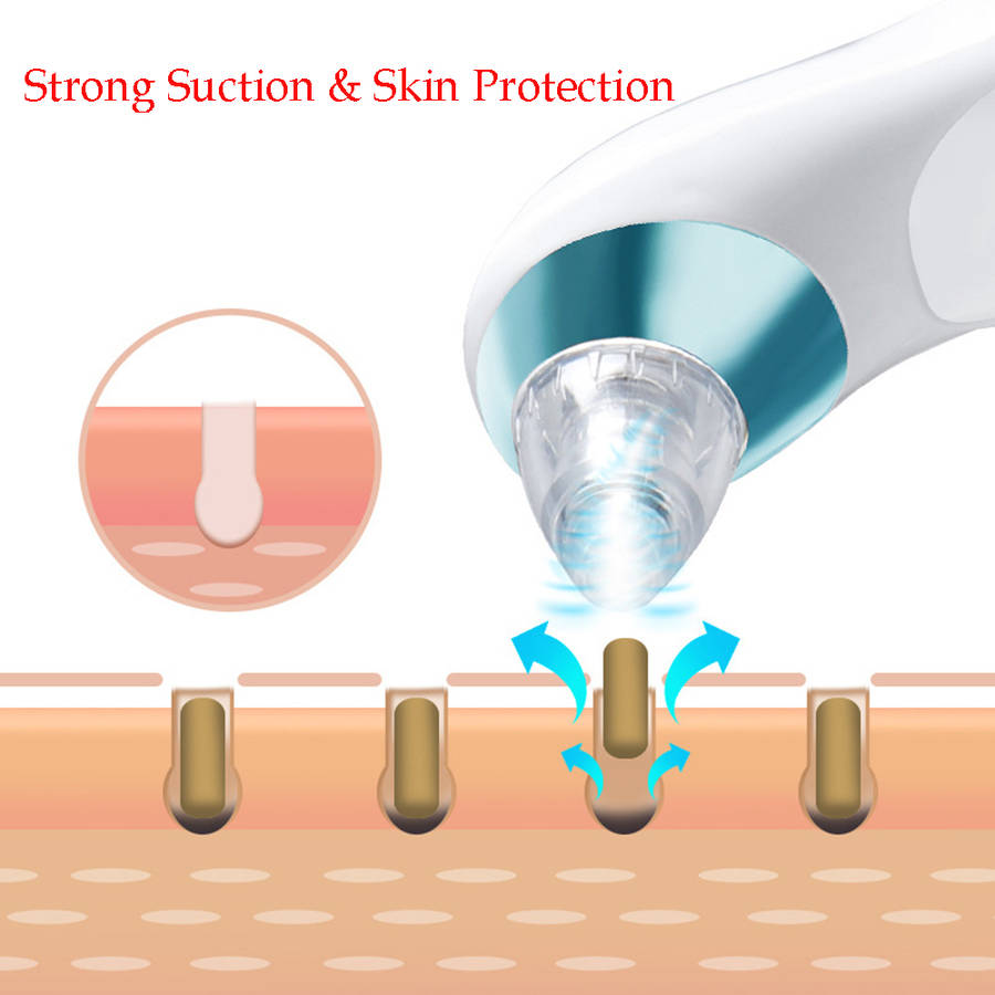 Electronic Blackhead Remover Vacuum Cleaner with 4 Probe - Blue