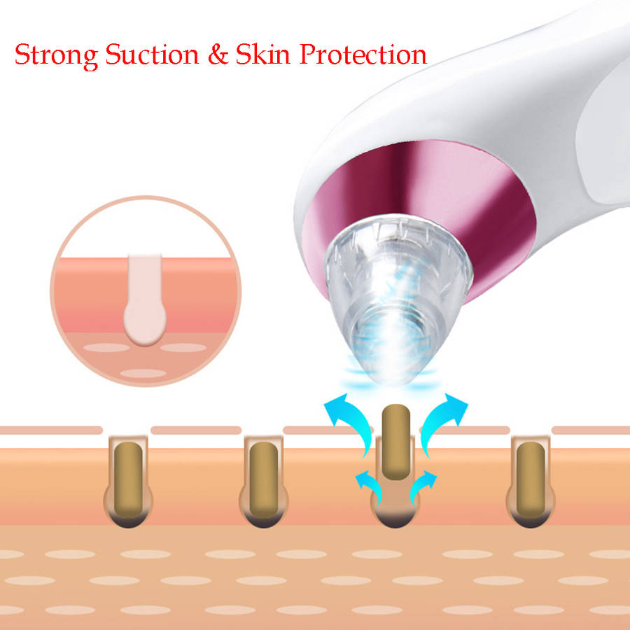 Electronic Blackhead Remover Vacuum Cleaner with 4 Probe - Pink
