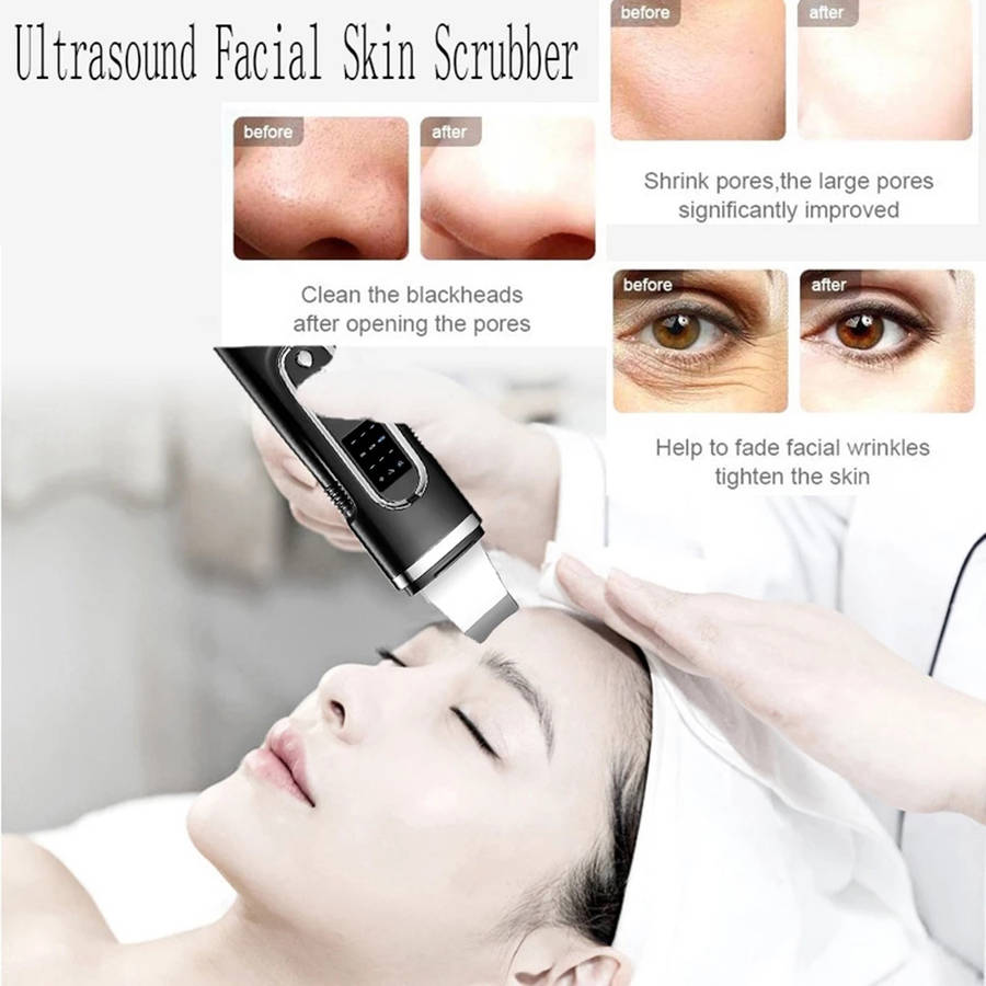 Ultrasonic Deep Face Cleaning Machine Skin Scrubber Shovel - Black