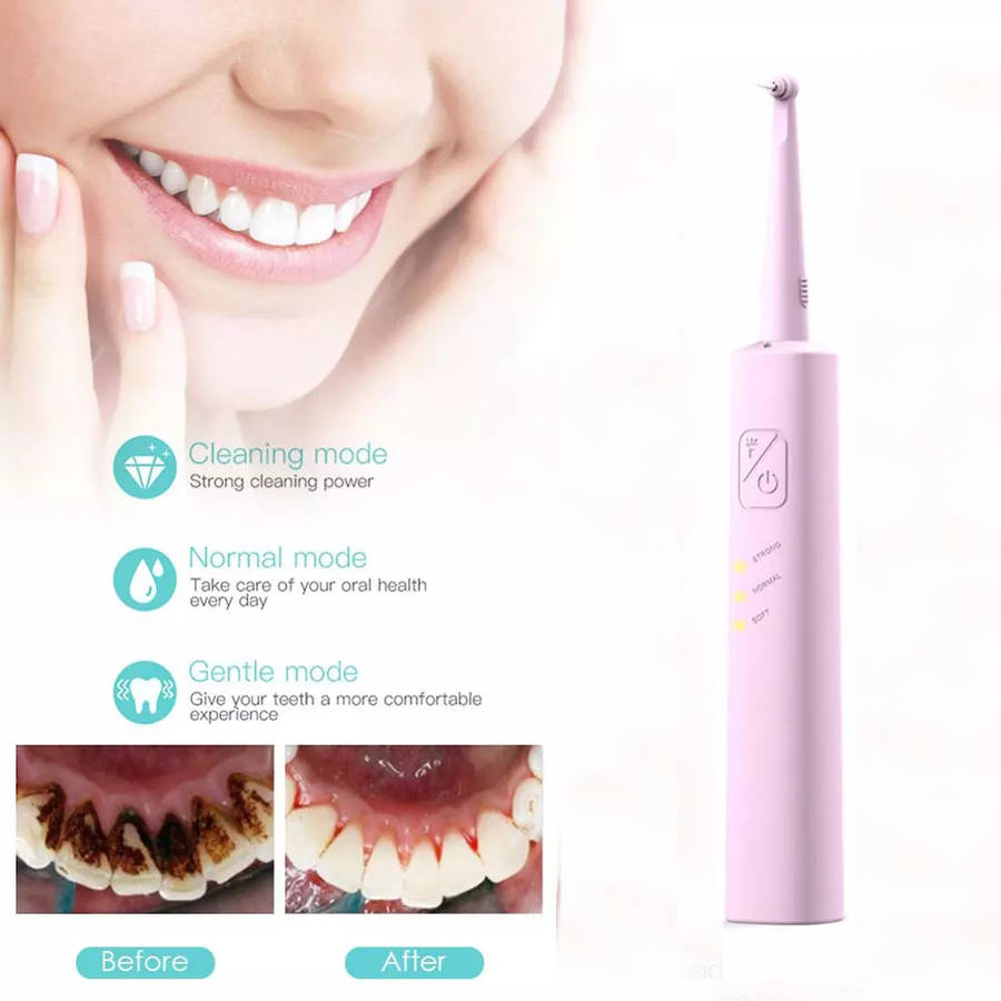 Household Electric Sonic Dental Calculus Remover with LED Light - Pink