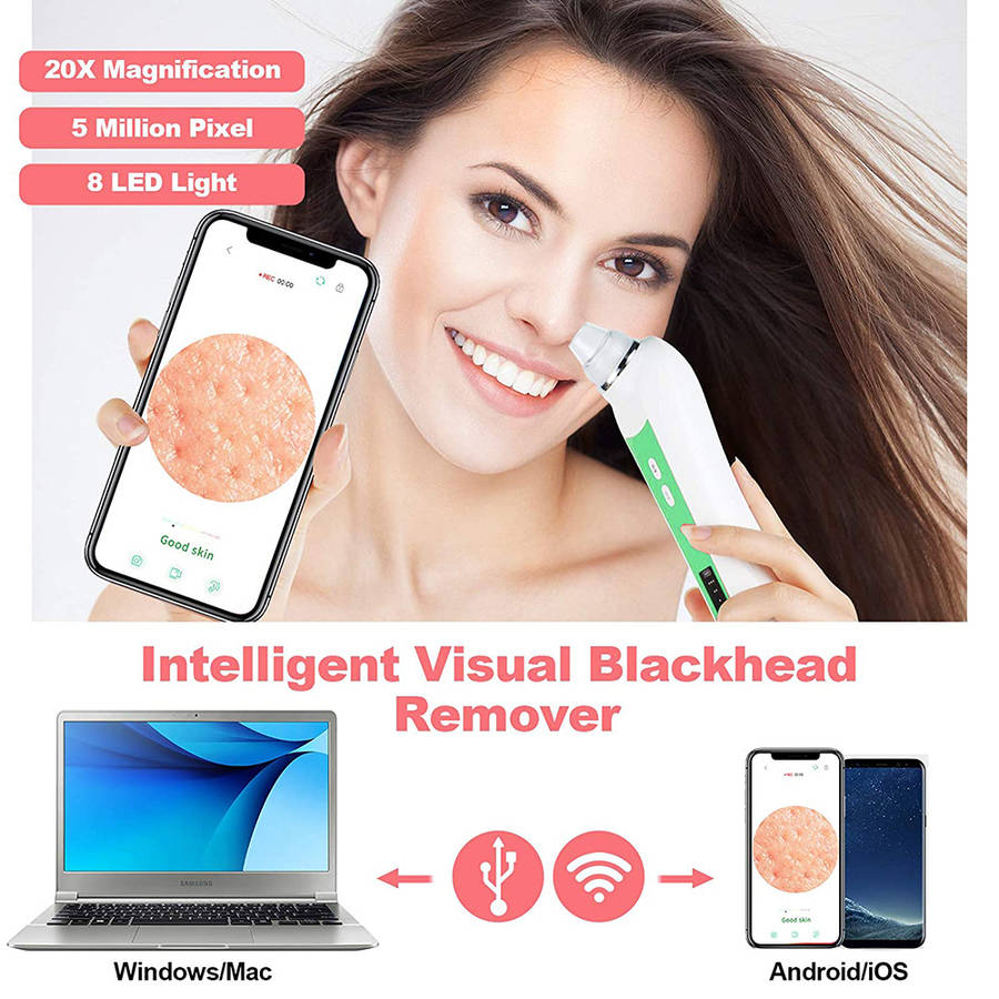 5MP WIFI 20X Magnification Visual Electric Blackhead Remover - Green