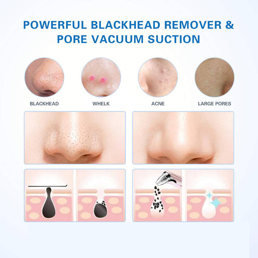 Electric Vacuum Pore Cleaner Blackhead Remover-Rose Gold