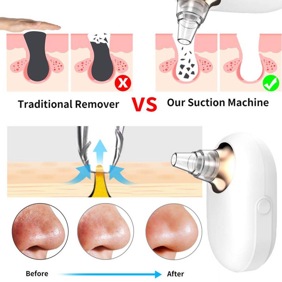 Electric Blackhead Remover Device Vacuum Pore Cleaner