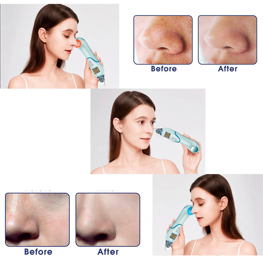 LED Display Blackhead Remover Vacuum Cleaner with Cold Hot Compress
