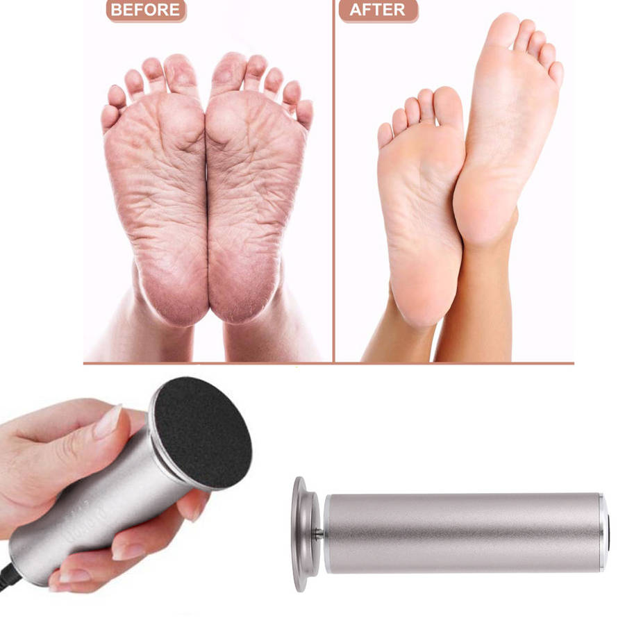 Electric Callus Remover