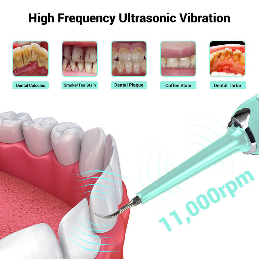 Electric Ultrasonic Sonic Dental Scaler Tooth Calculus Remover Set-Blue