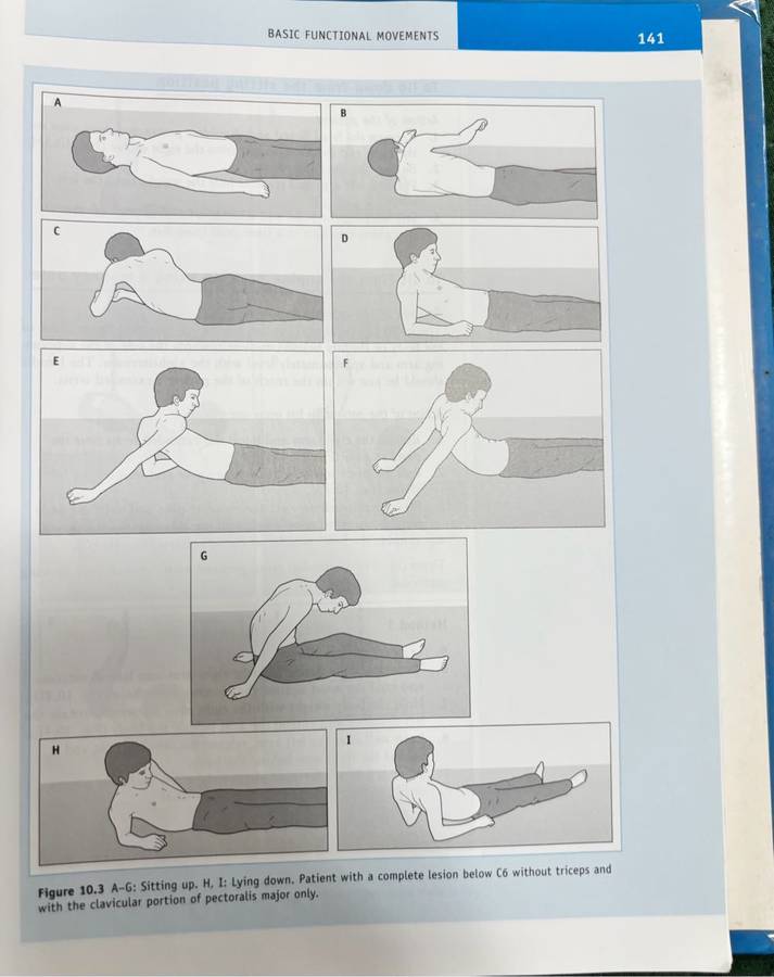 Tetraplegia and Paraplegia Guide for PHYSIOTHERAPISTS 6th Edition Ida Bromley