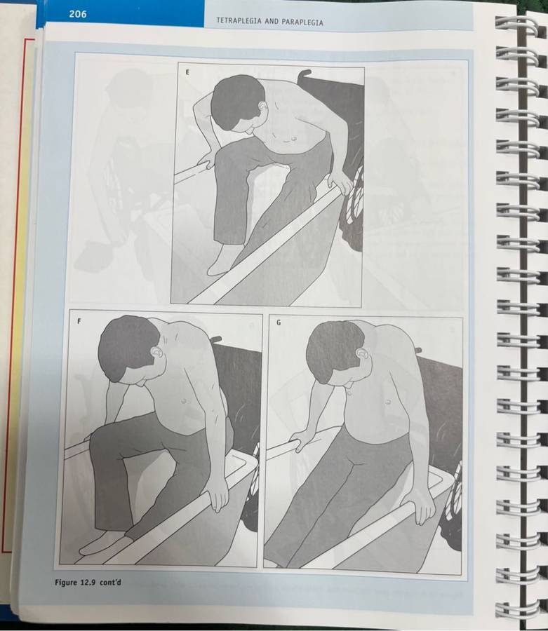 Tetraplegia and Paraplegia Guide for PHYSIOTHERAPISTS 6th Edition Ida Bromley