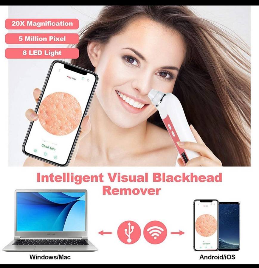 Electric blackhead remover